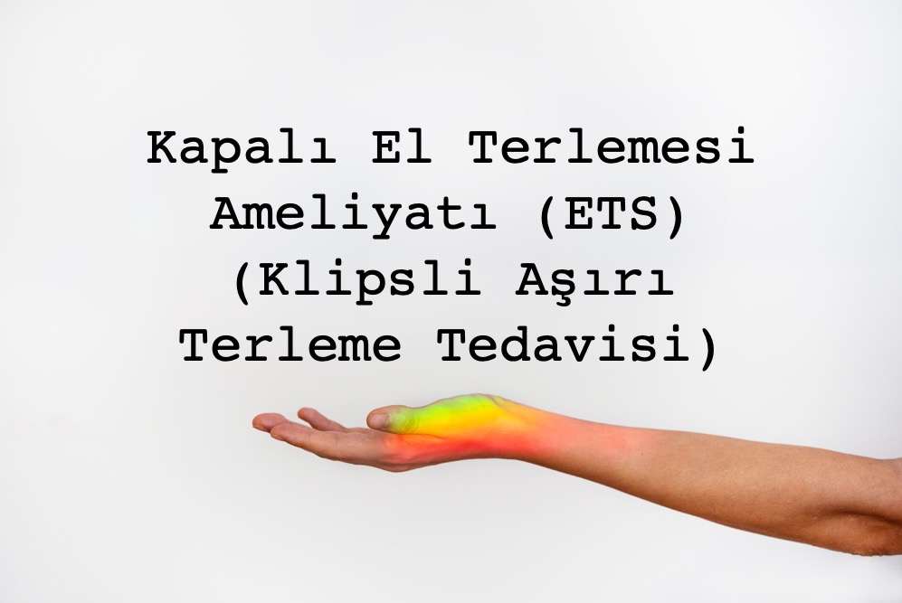 Kapalı el terlemesi ameliyatı ETS yöntemi