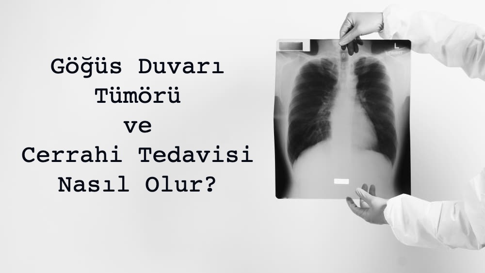 Göğüs Duvarı Cerrahisi