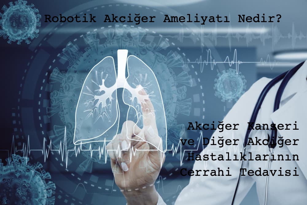 Robotik Akciğer Ameliyatı Nedir? Akciğer Kanseri ve Diğer Akciğer Hastalıklarının Cerrahi Tedavisi